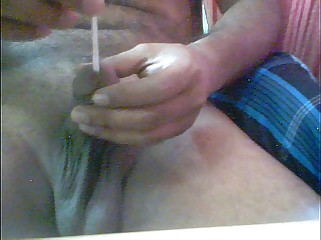 Fisting
